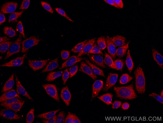 GSTP1 Antibody in Immunocytochemistry (ICC/IF)