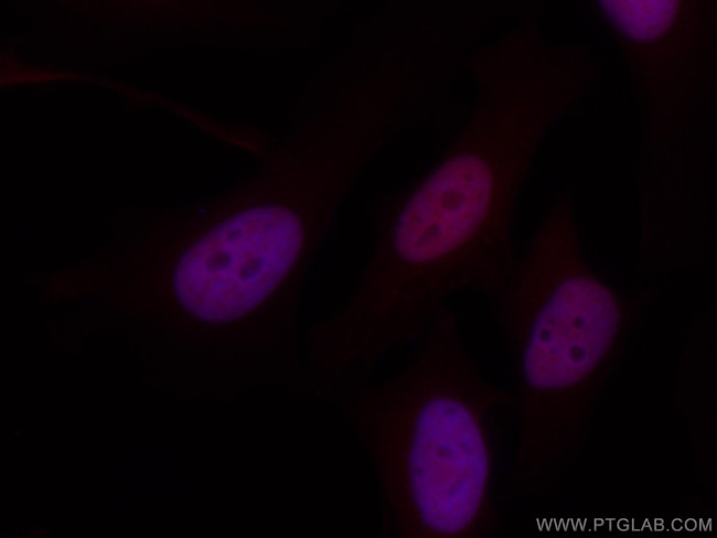 RBX1 Antibody in Immunocytochemistry (ICC/IF)