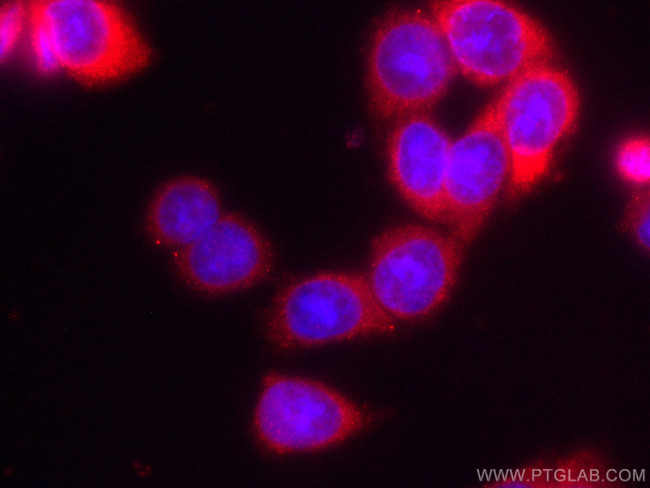 AGR2 Antibody in Immunocytochemistry (ICC/IF)