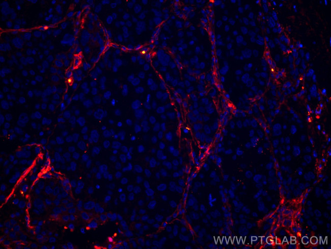 Collagen Type VI Antibody in Immunohistochemistry (Paraffin) (IHC (P))