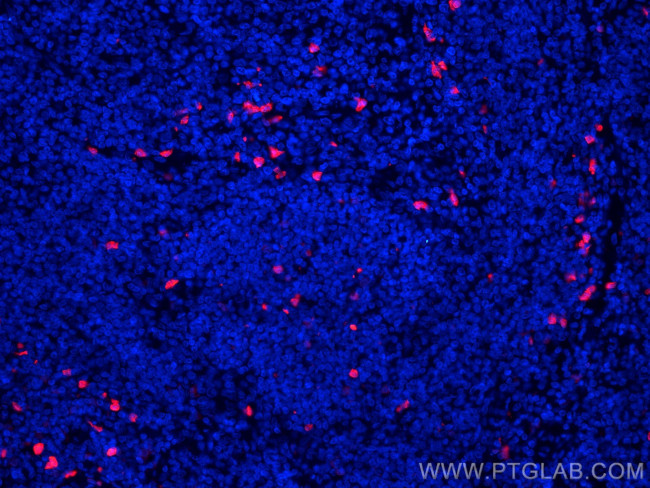 S100A8 Antibody in Immunohistochemistry (Paraffin) (IHC (P))