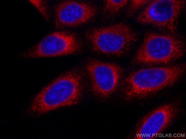 INF2 Antibody in Immunocytochemistry (ICC/IF)
