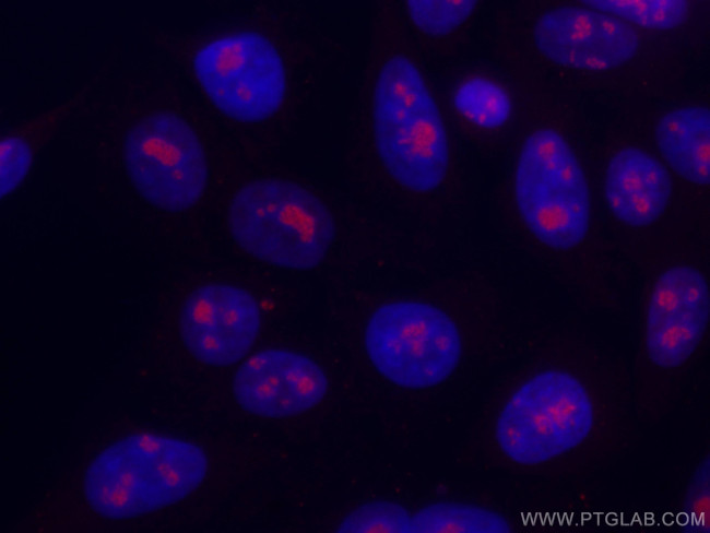DDX21 Antibody in Immunocytochemistry (ICC/IF)