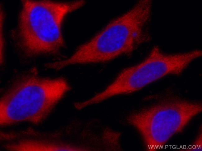 RACK1, GNB2L1 Antibody in Immunocytochemistry (ICC/IF)