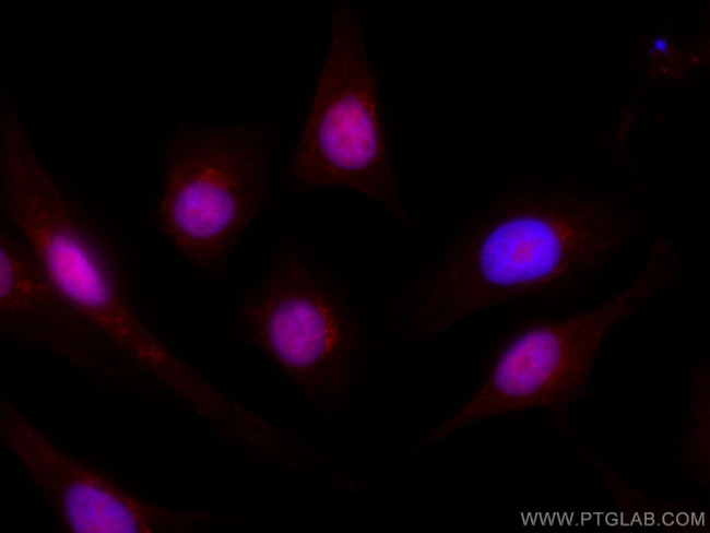 RDM1 Antibody in Immunocytochemistry (ICC/IF)