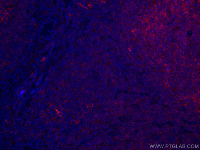 CD40 Antibody in Immunohistochemistry (Paraffin) (IHC (P))