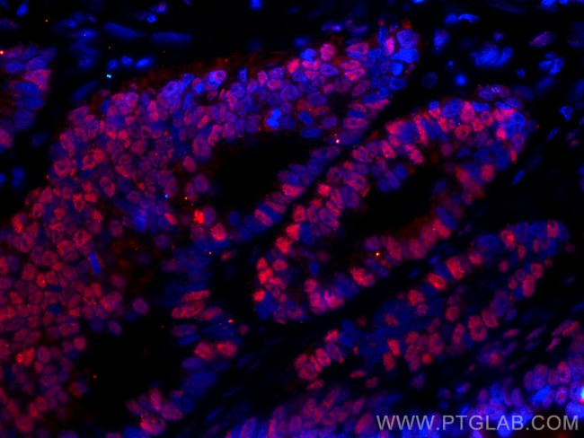 SMC1A Antibody in Immunohistochemistry (Paraffin) (IHC (P))