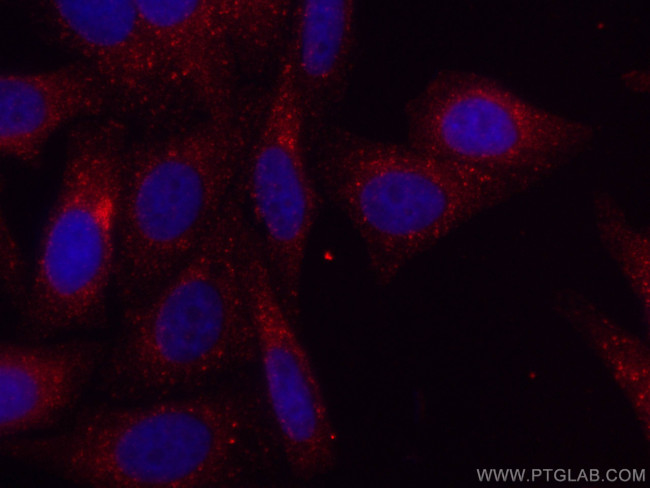 COMMD1 Antibody in Immunocytochemistry (ICC/IF)