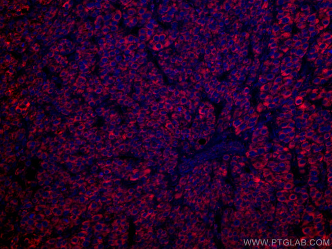GLUD1 Antibody in Immunohistochemistry (Paraffin) (IHC (P))