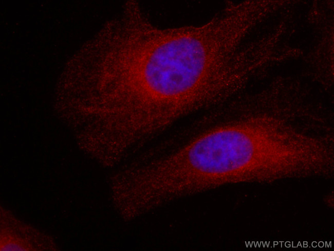 FLII Antibody in Immunocytochemistry (ICC/IF)