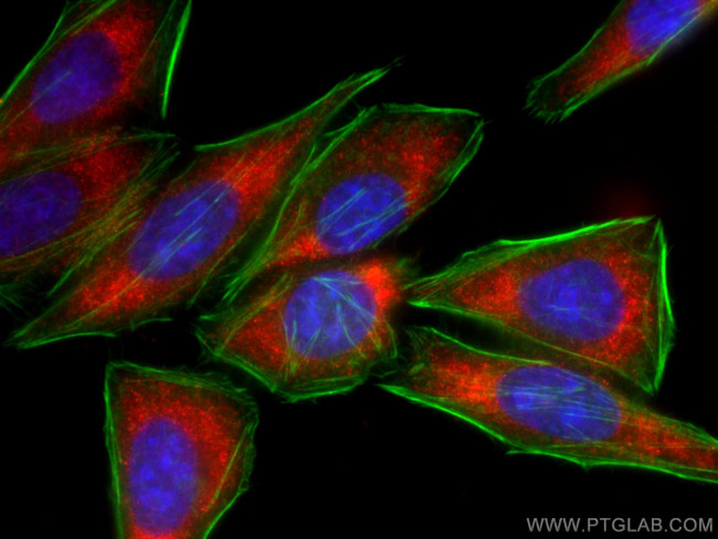 C1QA Antibody in Immunocytochemistry (ICC/IF)