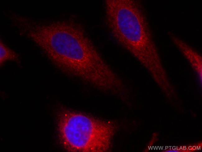 URG4 Antibody in Immunocytochemistry (ICC/IF)