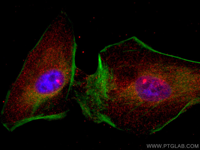 HIP1 Antibody in Immunocytochemistry (ICC/IF)