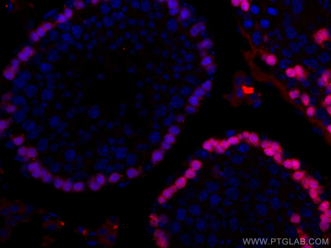 DMC1 Antibody in Immunohistochemistry (Paraffin) (IHC (P))