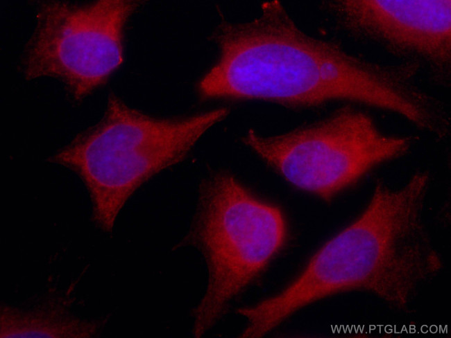 ENO1 Antibody in Immunocytochemistry (ICC/IF)