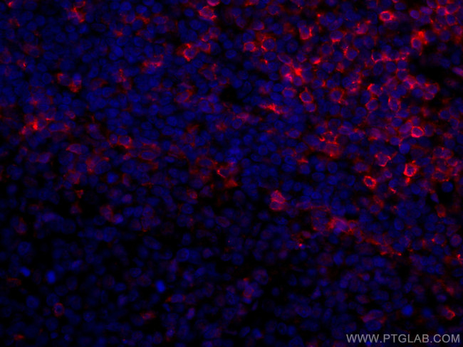 CD5 Antibody in Immunohistochemistry (Paraffin) (IHC (P))