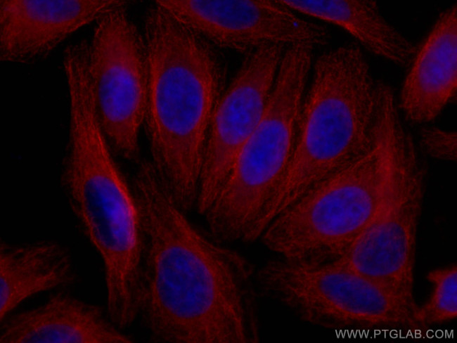 Alpha 2-Antiplasmin Antibody in Immunocytochemistry (ICC/IF)