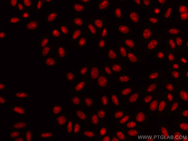 SSRP1 Antibody in Immunocytochemistry (ICC/IF)