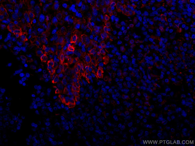 TLR8 Antibody in Immunohistochemistry (Paraffin) (IHC (P))