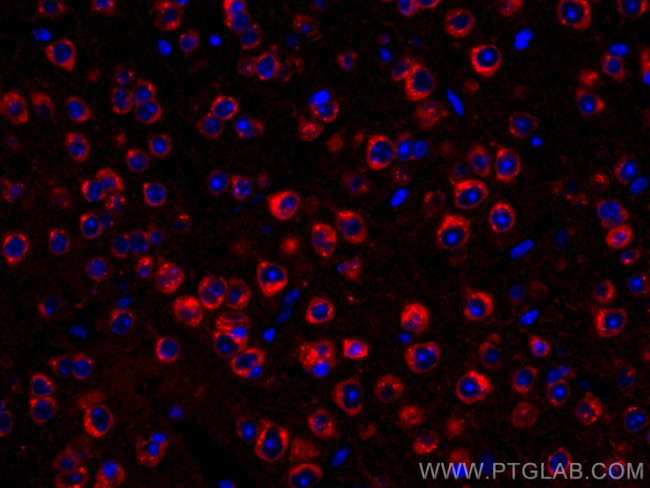 Alpha SNAP Antibody in Immunohistochemistry (Paraffin) (IHC (P))