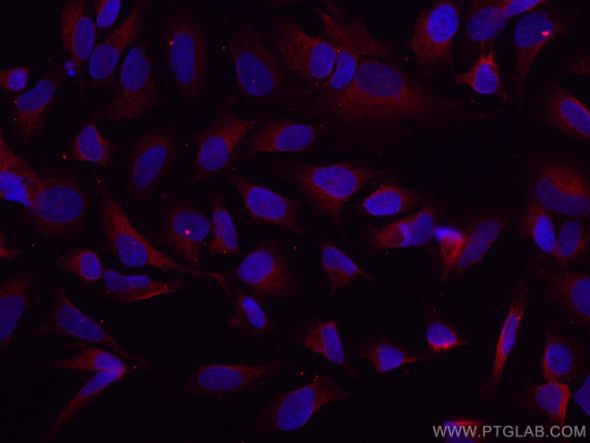 GSK3B Antibody in Immunocytochemistry (ICC/IF)