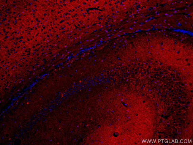 SYNPO Antibody in Immunohistochemistry (Paraffin) (IHC (P))