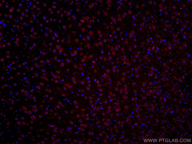 TRIM2 Antibody in Immunohistochemistry (Paraffin) (IHC (P))