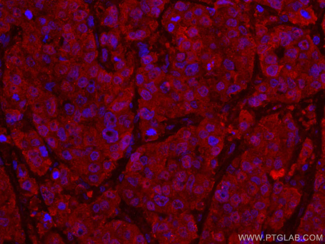 ANAPC5 Antibody in Immunohistochemistry (Paraffin) (IHC (P))