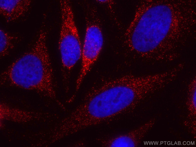 PNPLA3 Antibody in Immunocytochemistry (ICC/IF)