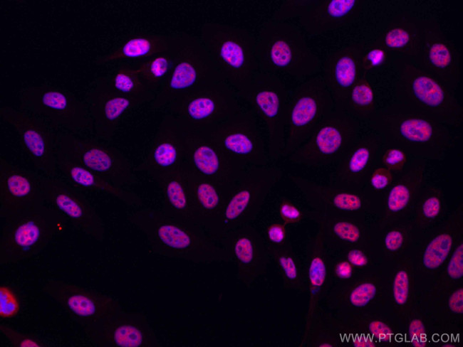 HNRNPH1 Antibody in Immunocytochemistry (ICC/IF)