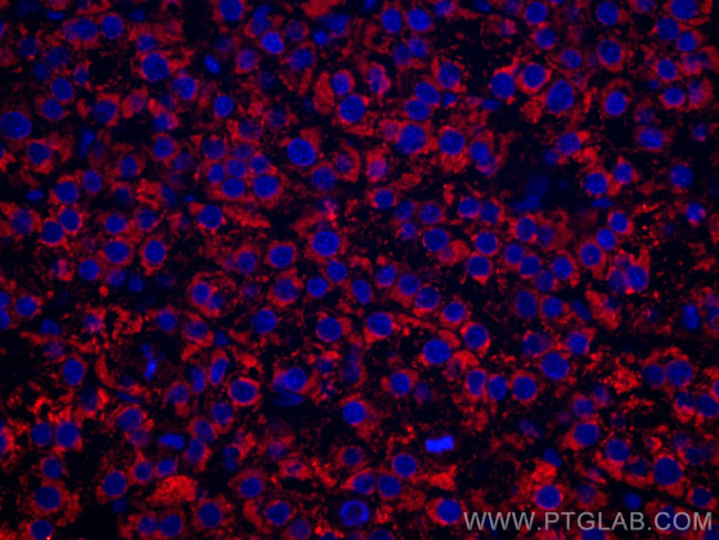 LACTB2 Antibody in Immunohistochemistry (Paraffin) (IHC (P))