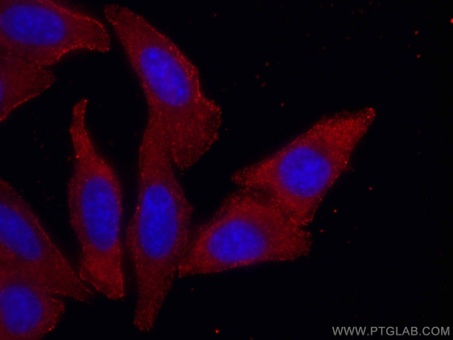 SEC24D Antibody in Immunocytochemistry (ICC/IF)