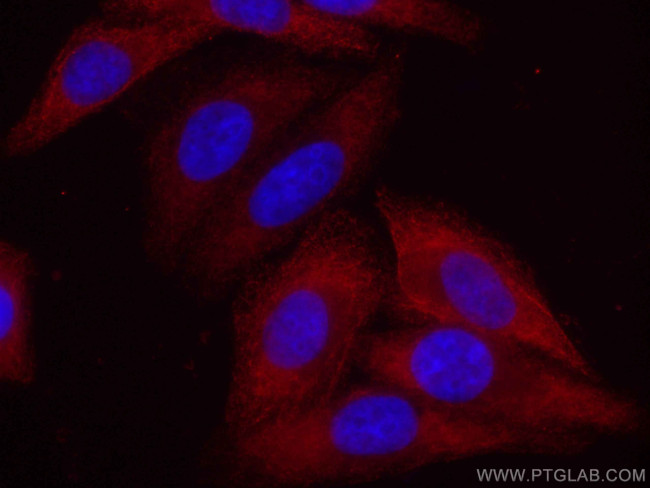 eIF4G2/DAP5 Antibody in Immunocytochemistry (ICC/IF)