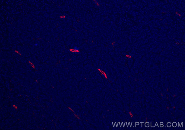 TTPA Antibody in Immunohistochemistry (Paraffin) (IHC (P))