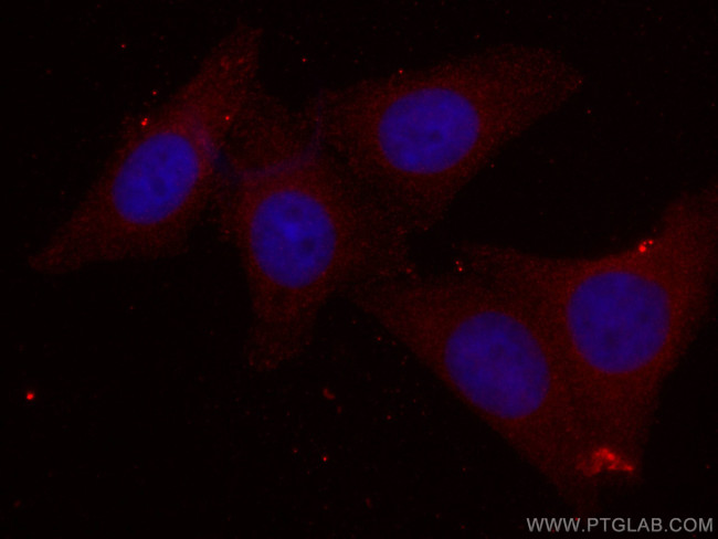 PPM1D Antibody in Immunocytochemistry (ICC/IF)