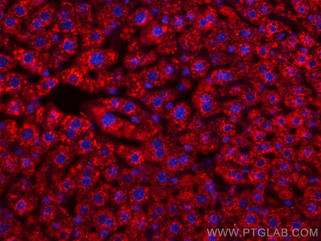 BDH1 Antibody in Immunohistochemistry (Paraffin) (IHC (P))