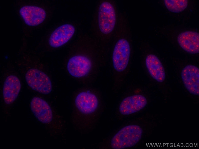 SF3B3 Antibody in Immunocytochemistry (ICC/IF)