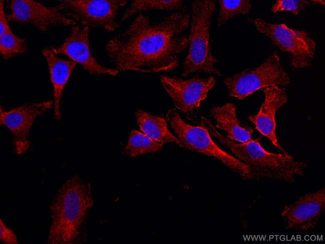 BSEP Antibody in Immunocytochemistry (ICC/IF)