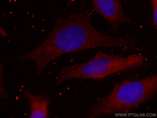 CMPK1 Antibody in Immunocytochemistry (ICC/IF)
