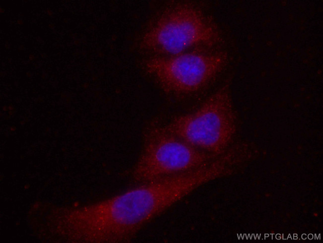 FES Antibody in Immunocytochemistry (ICC/IF)
