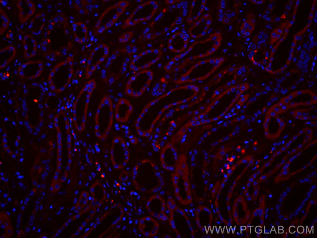 SLC2A9 Antibody in Immunohistochemistry (Paraffin) (IHC (P))