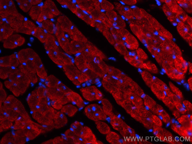 MYL4 Antibody in Immunohistochemistry (Paraffin) (IHC (P))