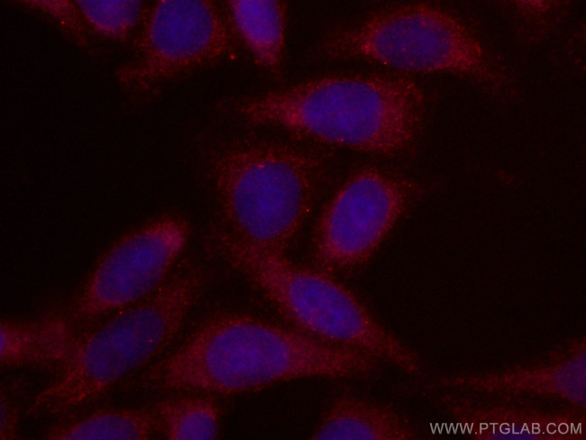 GRP75 Antibody in Immunocytochemistry (ICC/IF)