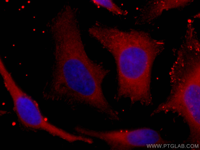 PHGDH Antibody in Immunocytochemistry (ICC/IF)