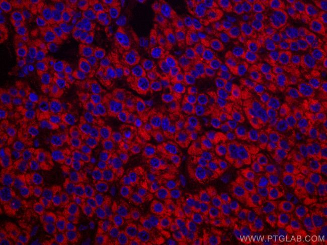 SDHB Antibody in Immunohistochemistry (Paraffin) (IHC (P))