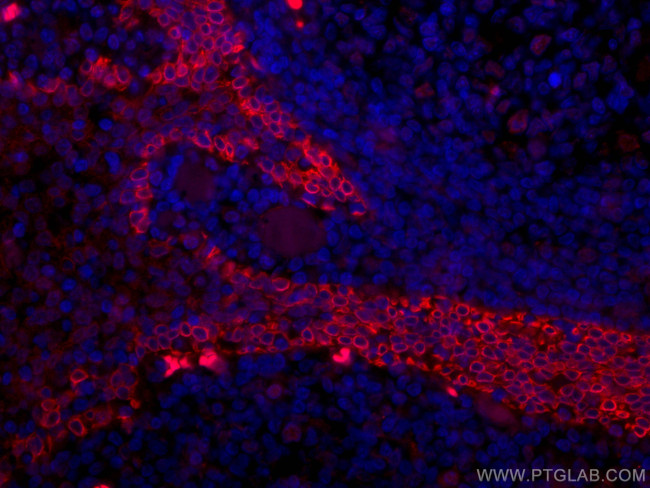 CD63 Antibody in Immunohistochemistry (Paraffin) (IHC (P))