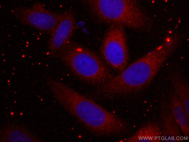 Ch-TOG Antibody in Immunocytochemistry (ICC/IF)