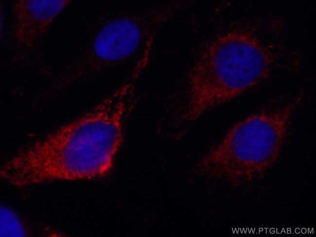 SNX5 Antibody in Immunocytochemistry (ICC/IF)