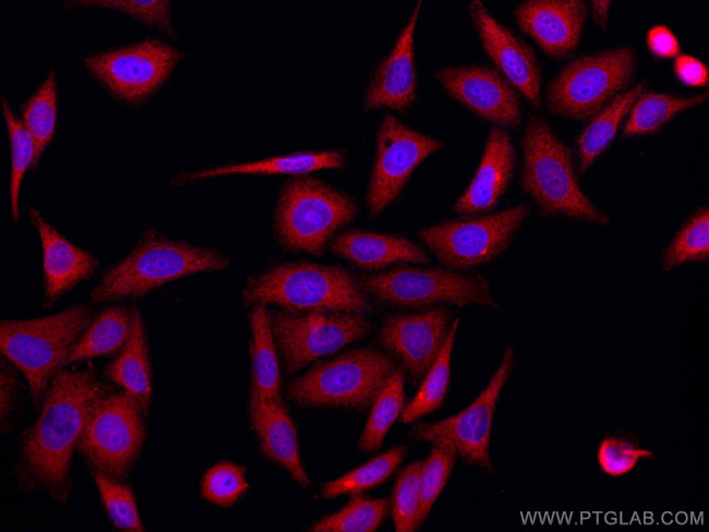 RPS12 Antibody in Immunocytochemistry (ICC/IF)