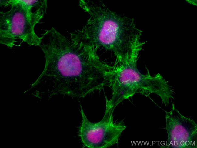 ANP32A Antibody in Immunocytochemistry (ICC/IF)
